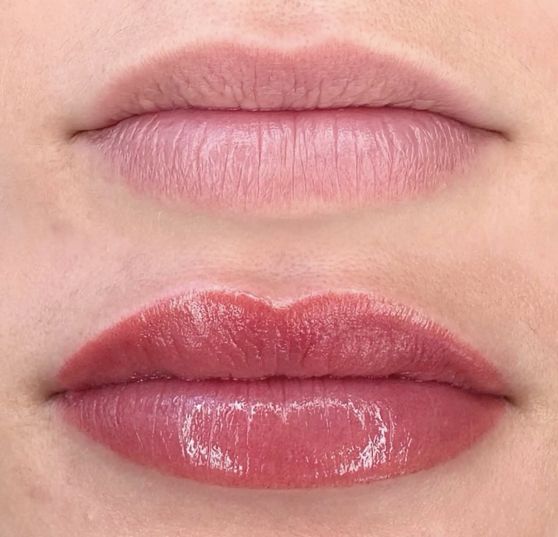 best products for lip healing