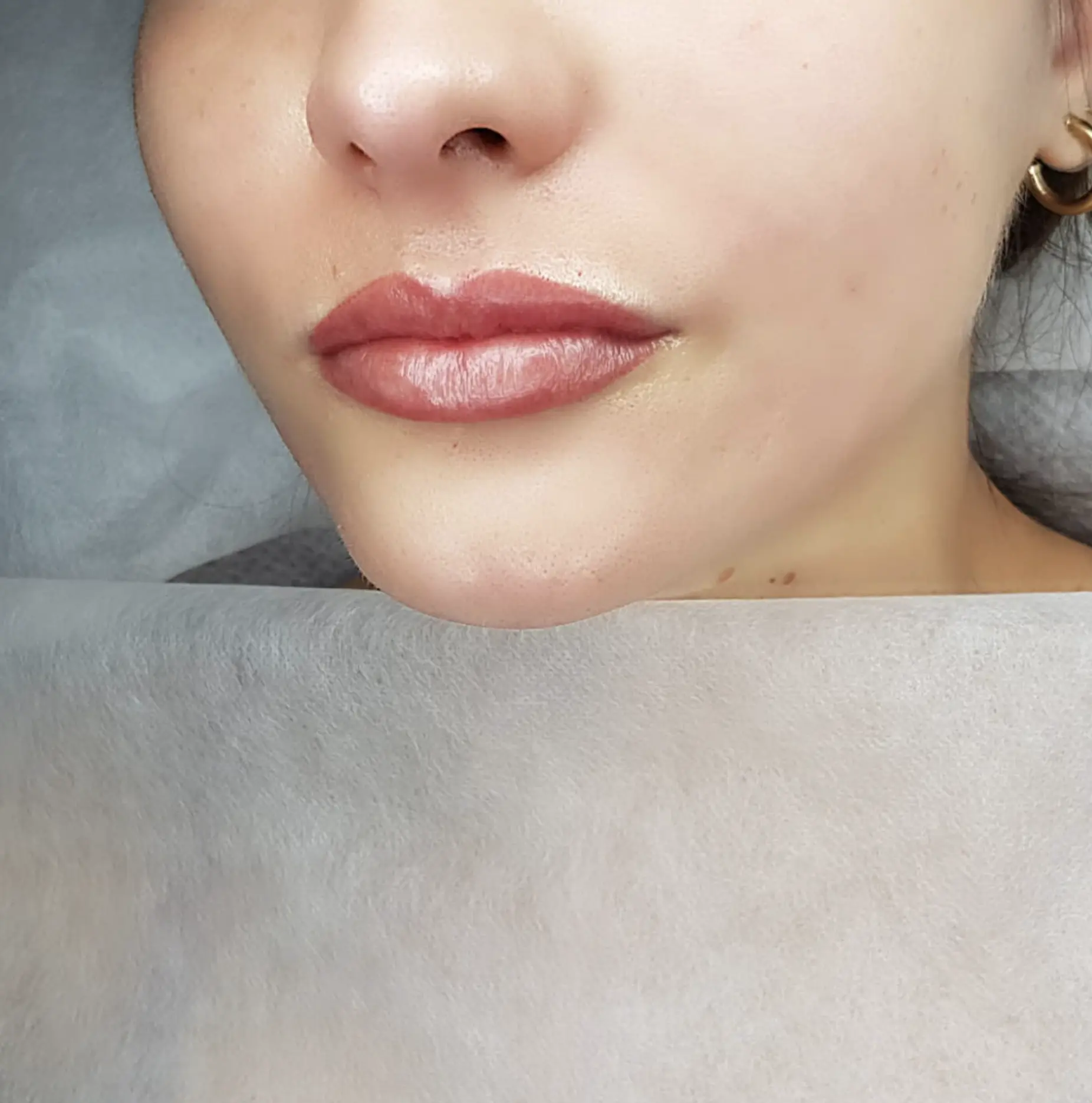 dark lip neutralisation Melbourne