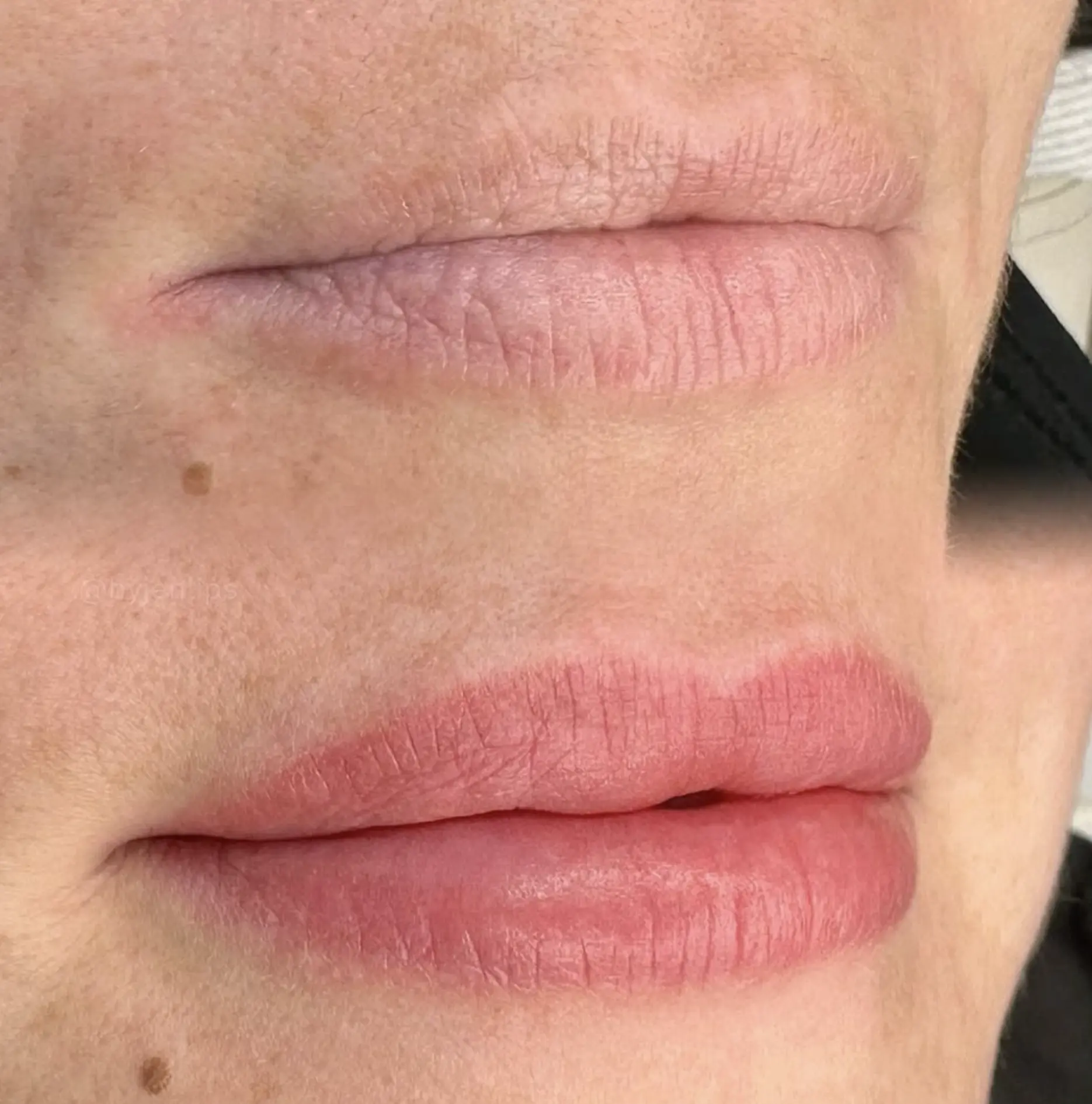 fast lip healing tips