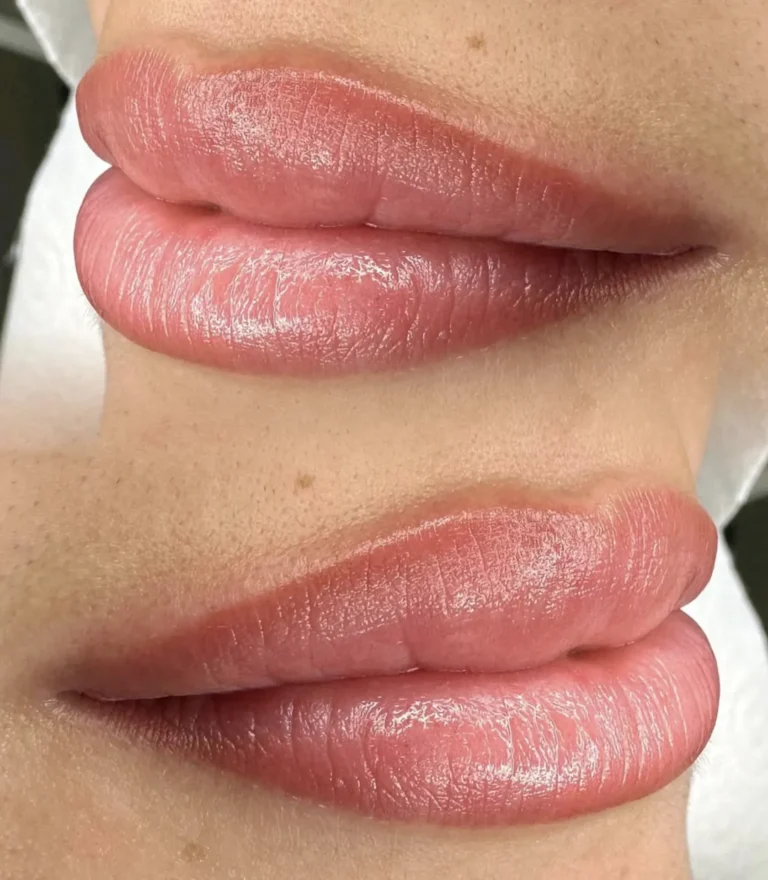 How Can I Speed Up Lip Healing?