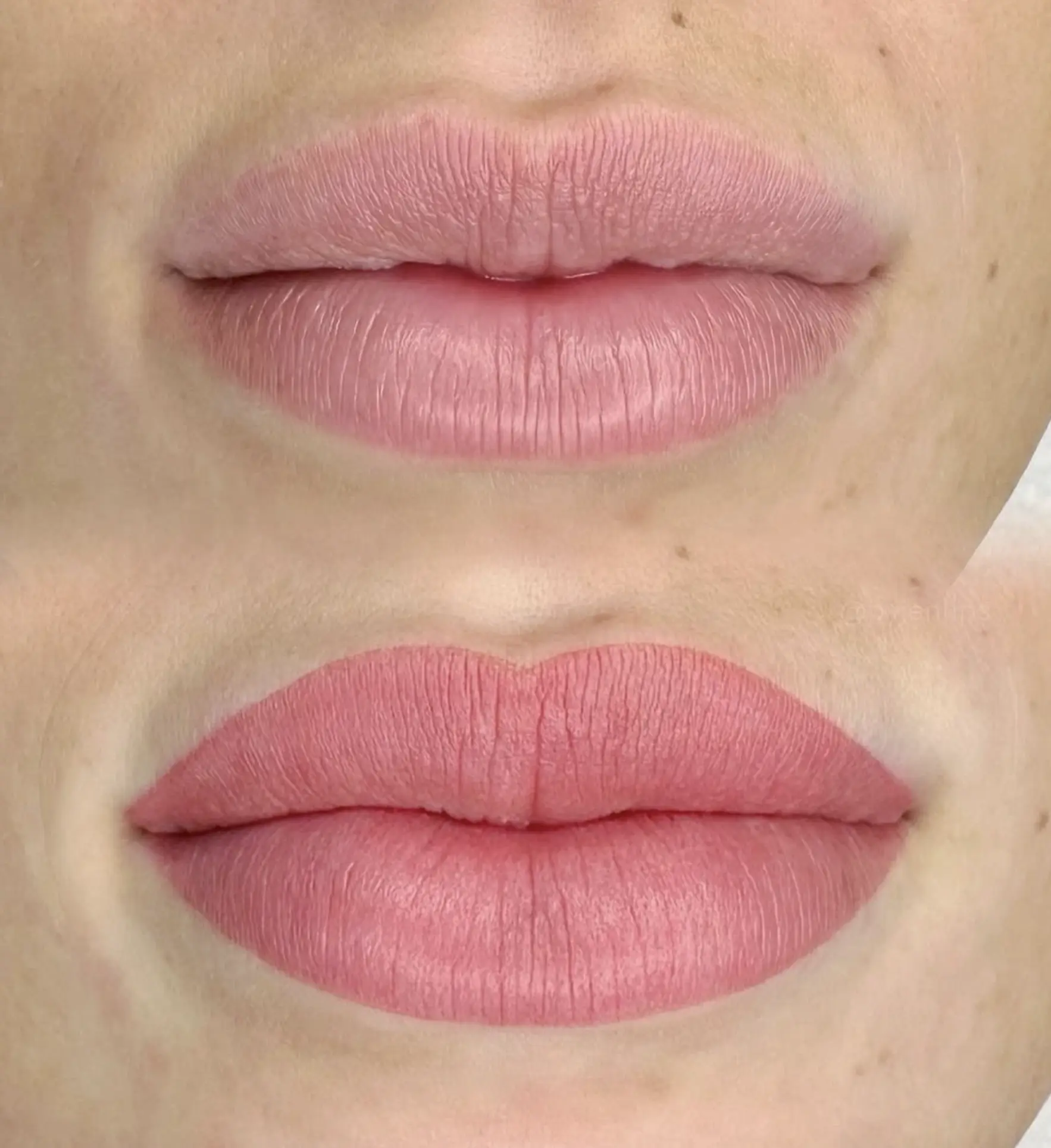 how to heal cracked lips quickly