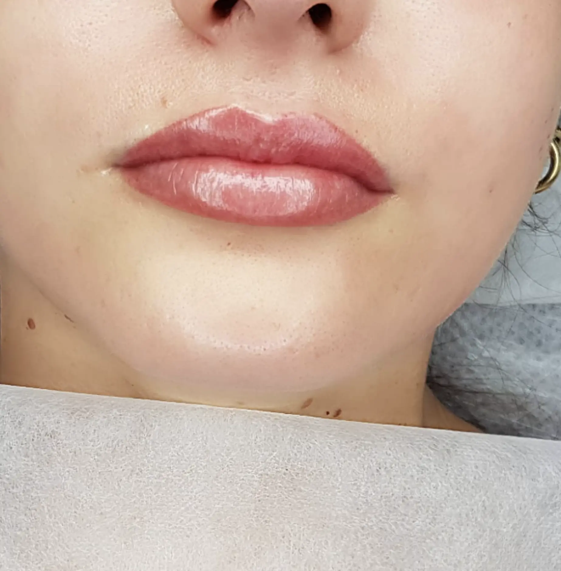 Melbourne lip care advice